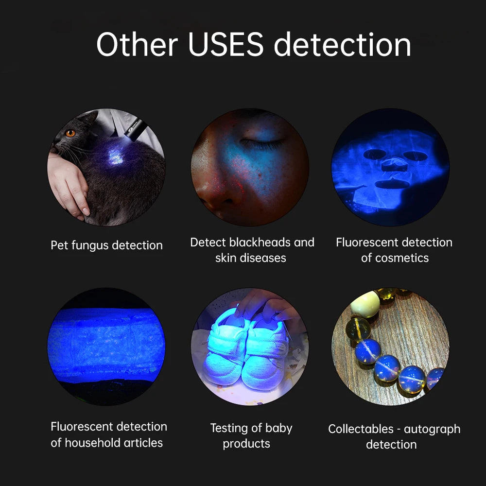 YOUWEMED Medical Woods Lamp Skin Examination Skin Fungus Detector Vitiligo Pityriasis Versicolor Melasma Detector Woods Light