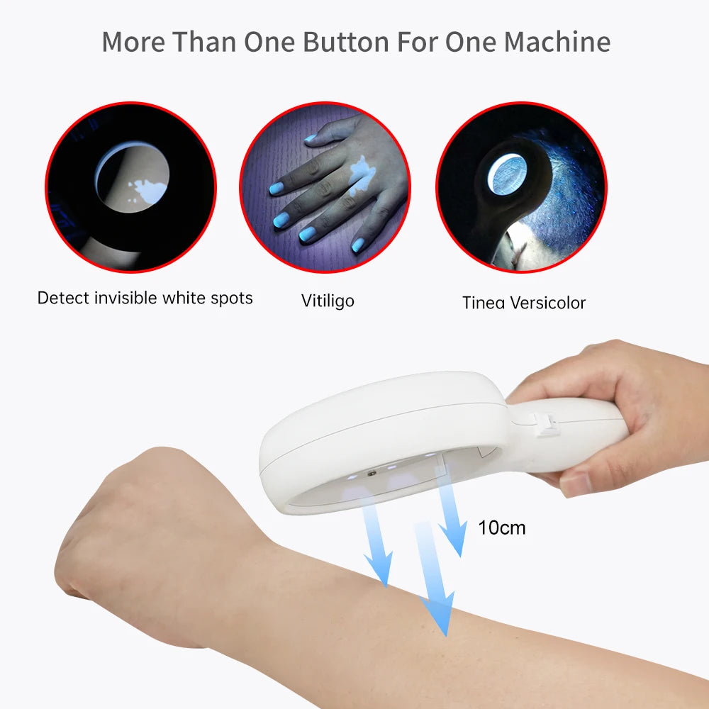YOUWEMED Medical Woods Lamp Skin Examination Skin Fungus Detector Vitiligo Pityriasis Versicolor Melasma Detector Woods Light