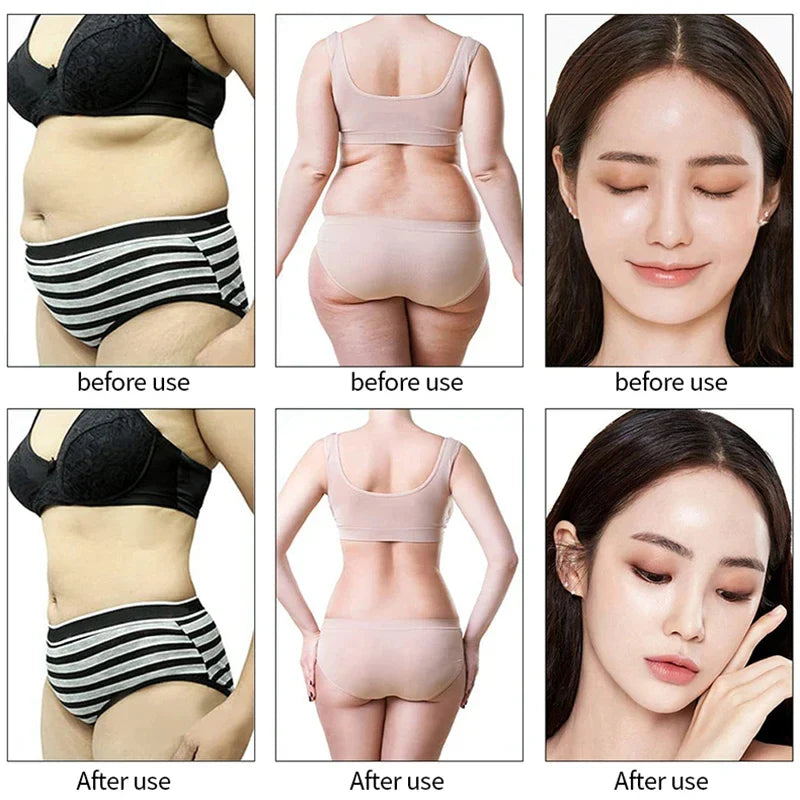 Newest 9-in-1 Lipolaser Cavitation Slimming Machine