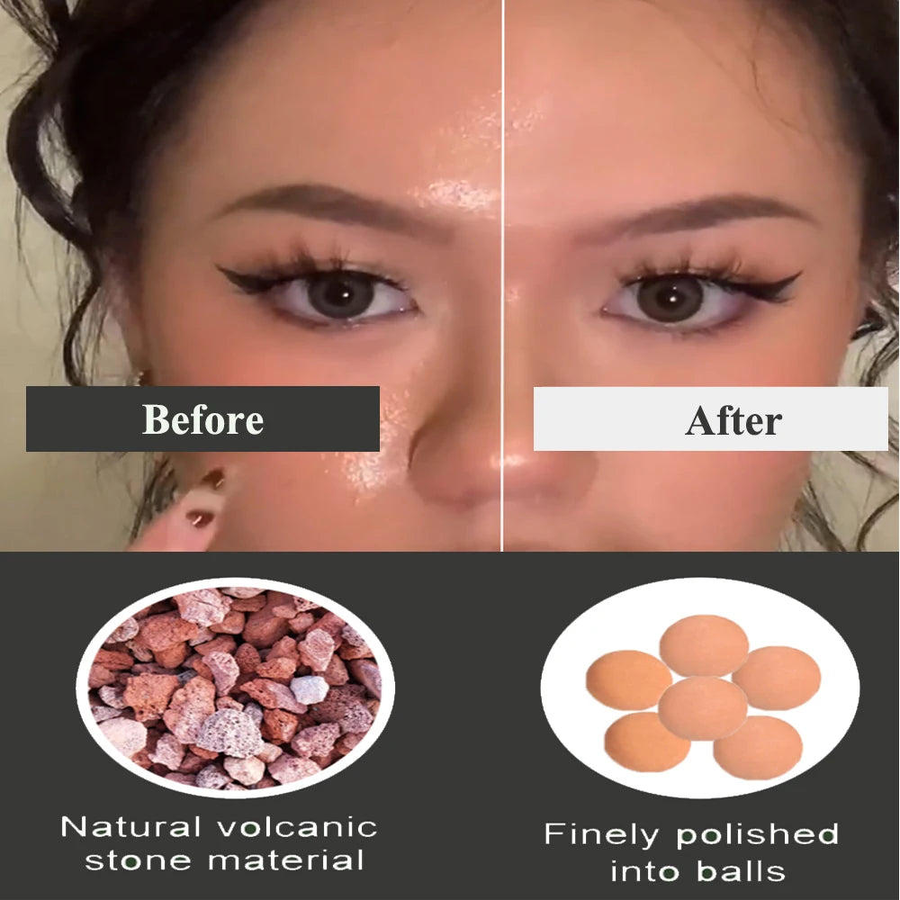 Volcanic Stone Face Roller Blemish Remover