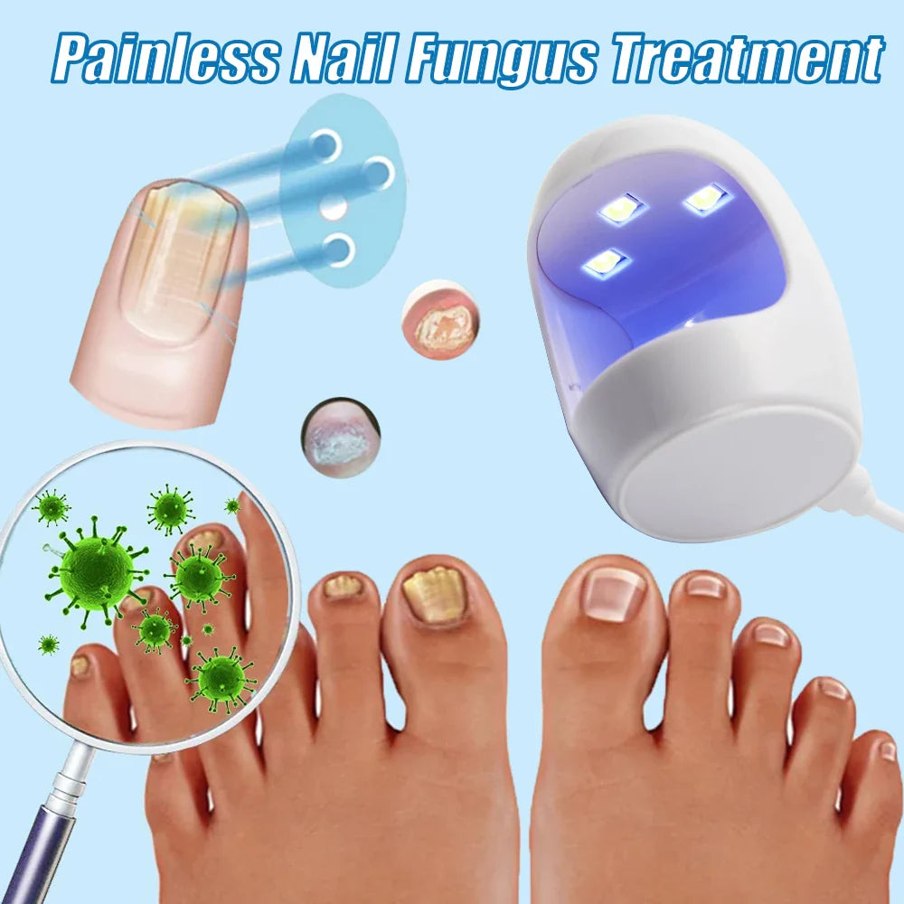 Laser Nail Fungus Treatment Device - Footcare