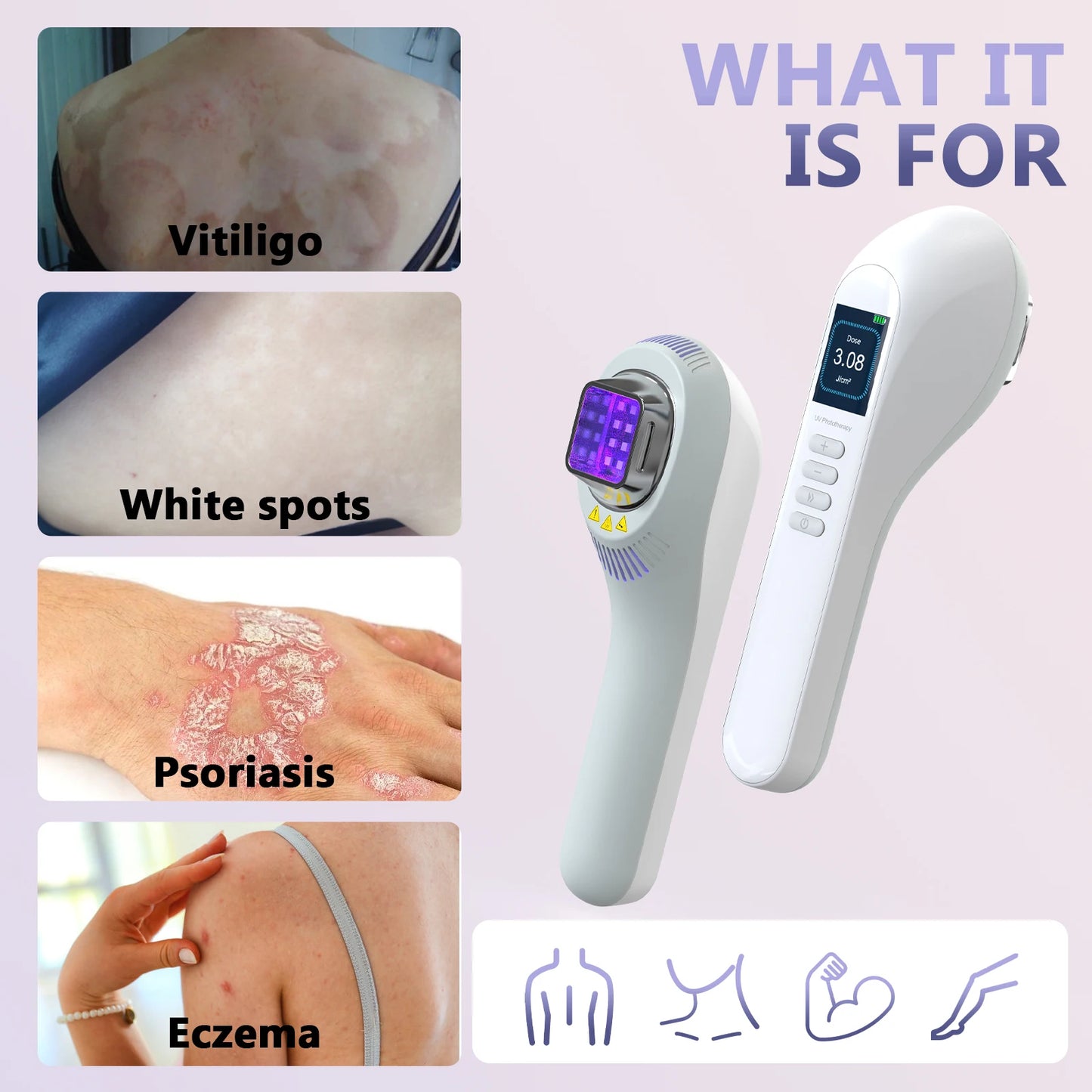 KTS 308nm UVB Vitiligo Lamp