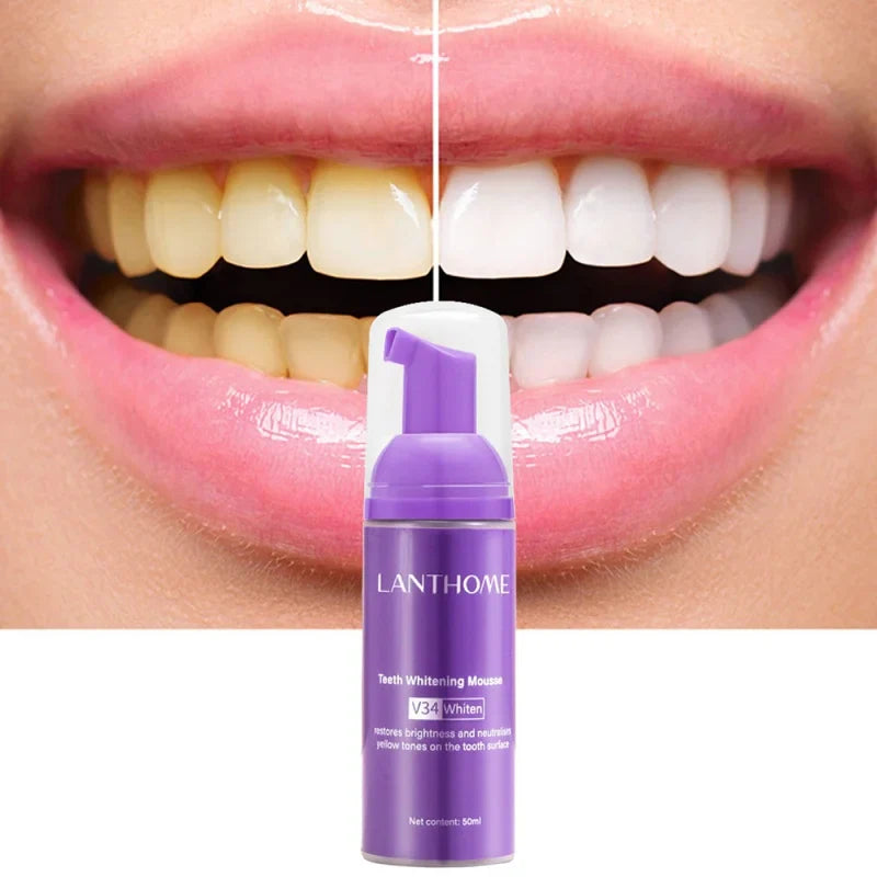 Teeth Whitening Mousse Toothpaste - Dental Care