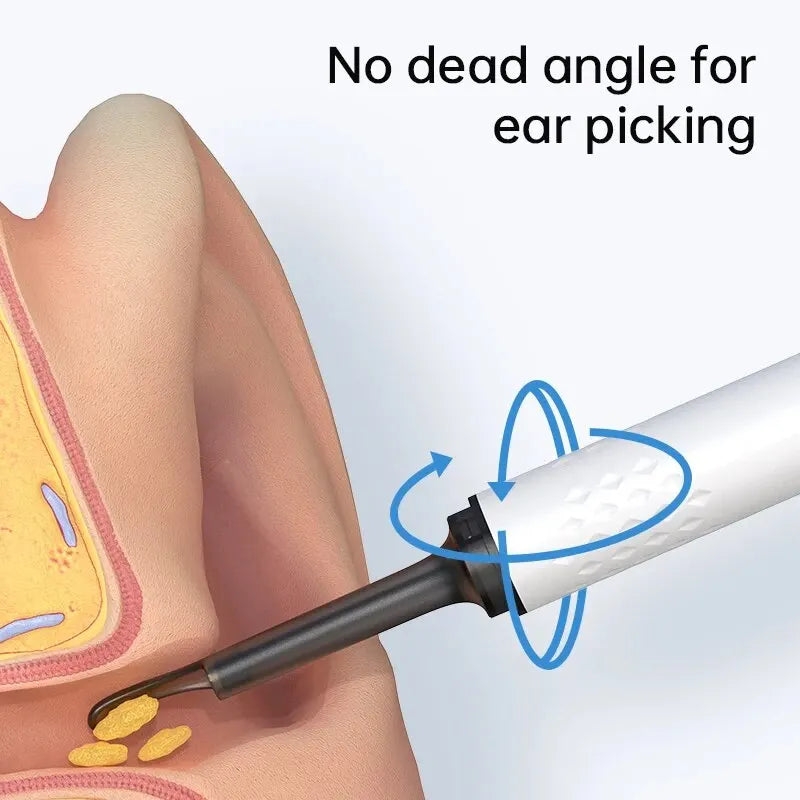 WIFI Visual Ear Cleaner Otoscope Camera - Ear Wax Removal Tool