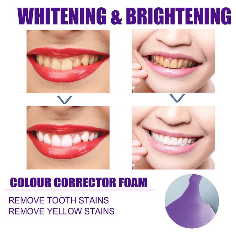 Teeth Whitening Mousse Toothpaste - Dental Care