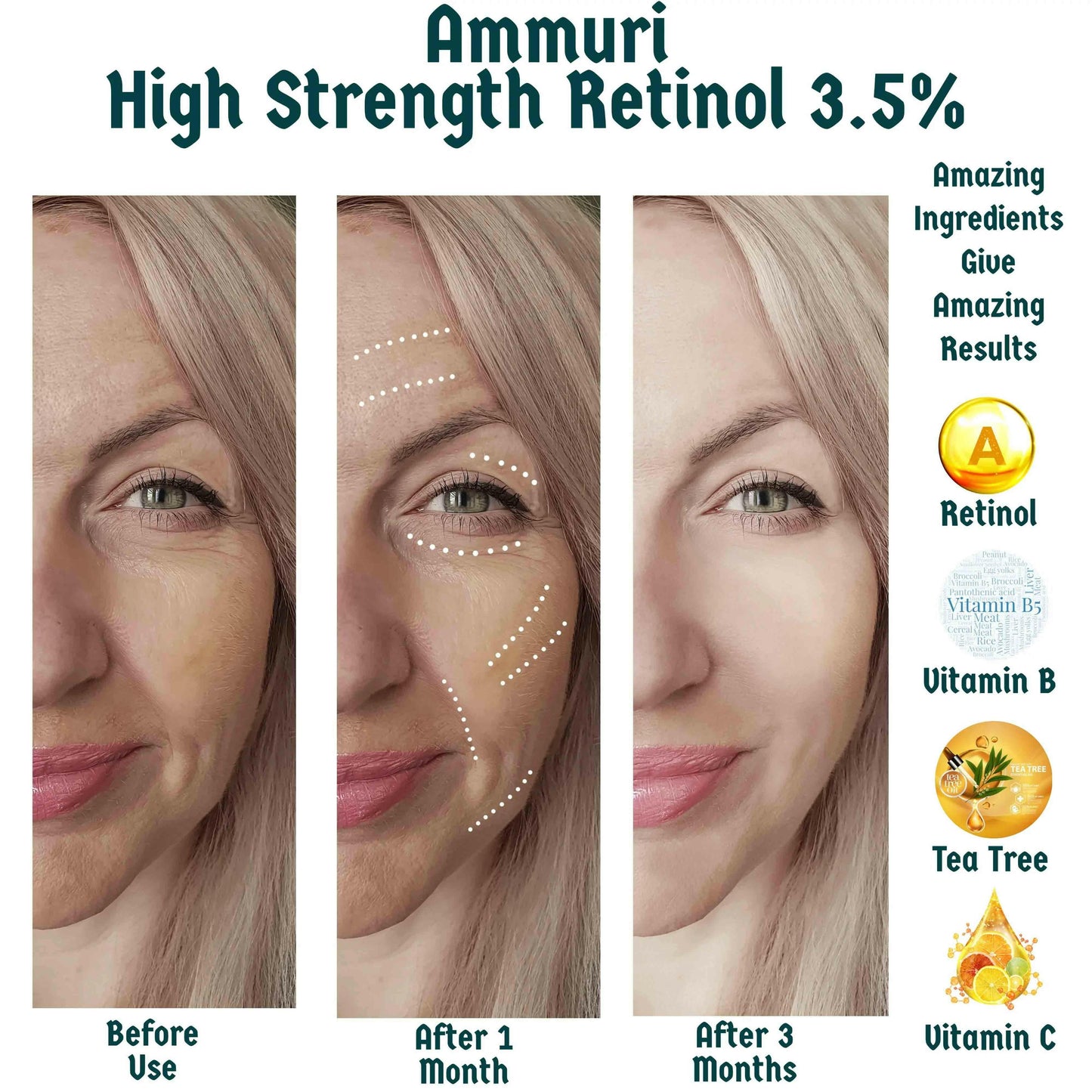 Ammuri Skincare High Strength Retinol Serum 3.5%
